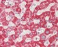 GGT1 / GGT Antibody (N-Terminus)